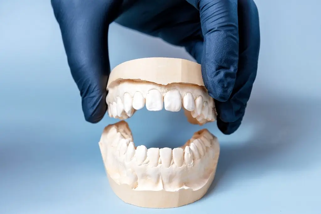 itero dental scanner